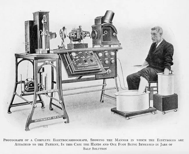 Early Holter monitor backpack system showing how electrocardiography became portable for longer-term monitoring