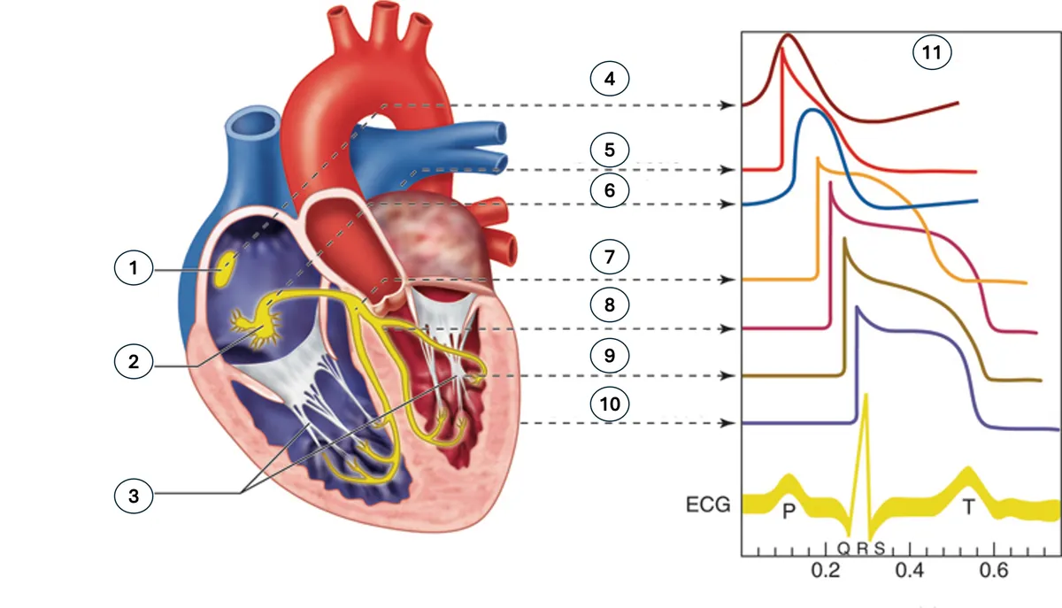 Illustration of the cardiac conduction system showing the SA node in the right atrium, the AV node low in the atrium, and conduction spreading through the His-Purkinje system into both ventricles