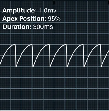 Image of the apex at 95% with positive amplitude